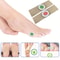 12pcs Corn Removal Pads Foot Callus Clavus Treatment Plasters For Pain Relief And Soft Healthy Fe 5