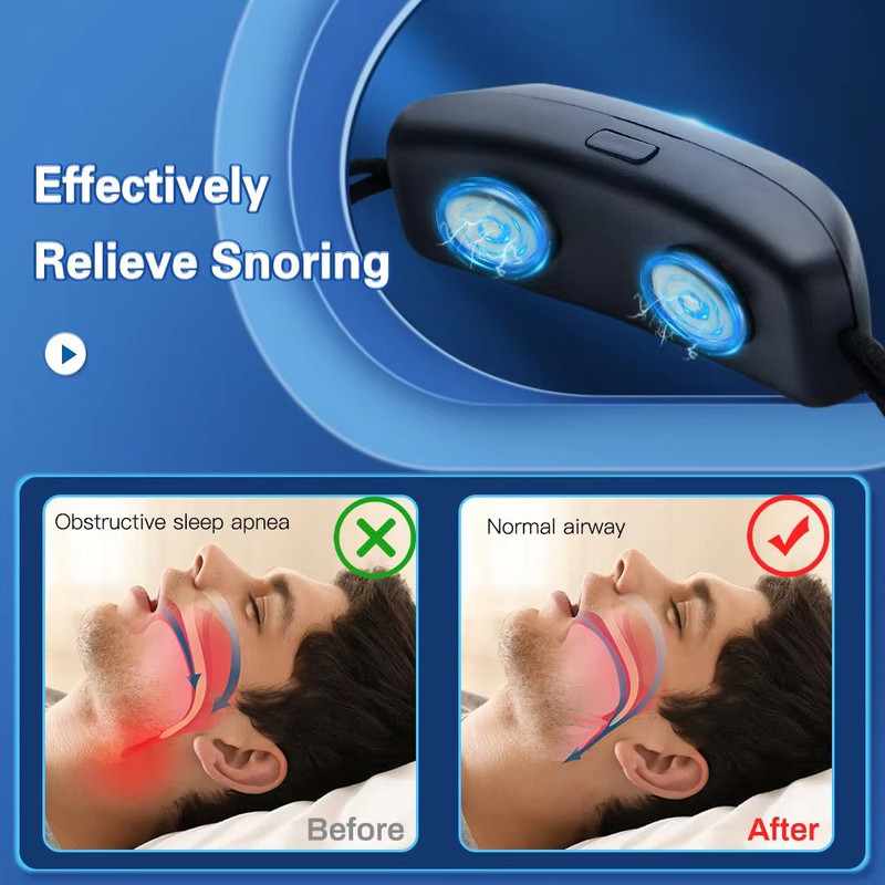 SmartSleep EMS AntiSnoring Device  USB Rechargeable Pulse Therapy Snore Stopper For Comfortable Res 3
