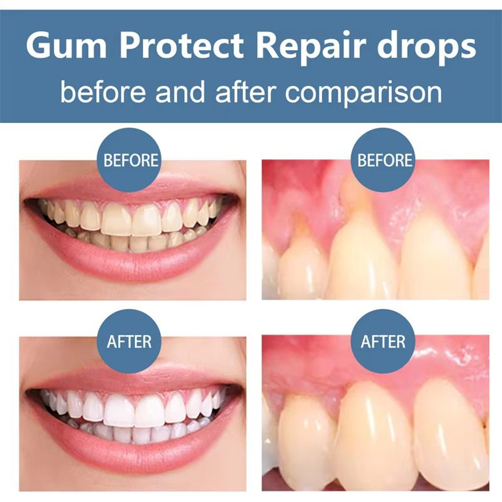 Rapid Repair Gums Serum  Instant Relief For Sensitive Teeth Cavities  Gum Damage 2