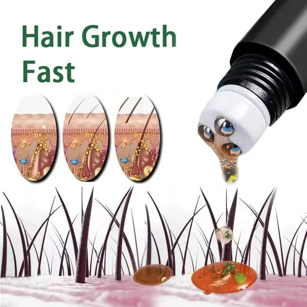 Vita Thick BiotinBoost Hair Growth Oil  Intensive Scalp  Hair Loss Repair Treatment 0