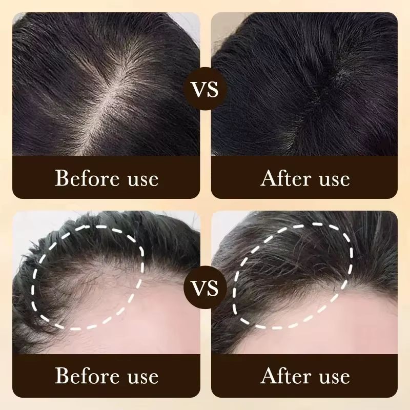 Vita Thick BiotinBoost Hair Growth Oil  Intensive Scalp  Hair Loss Repair Treatment 1