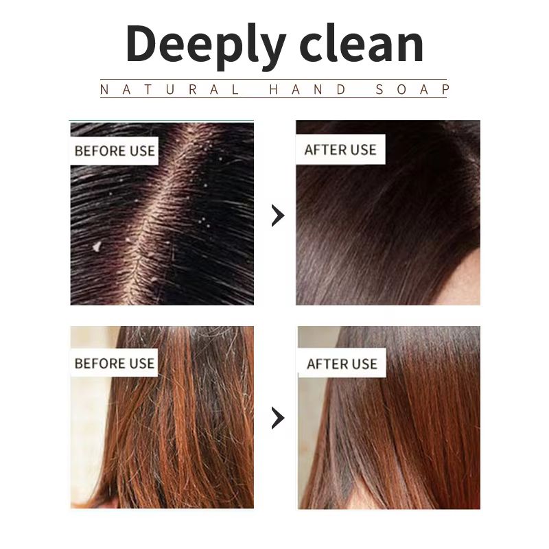 Purify  Balance TeaTree Oil Plant Shampoo  Refreshing Scalp  Stronger Hair 2