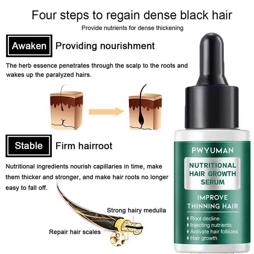 Ginger Germinal Hair Growth Serum  Intensive 7day Root Nourish And Hair Repair Elixir 3