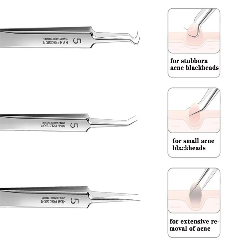 German UltraFine No 5 Blackhead  Pimple Tweezers  Precision Acne Needle Tool For Facial Care 2