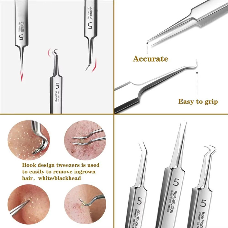 German UltraFine No 5 Blackhead  Pimple Tweezers  Precision Acne Needle Tool For Facial Care 3