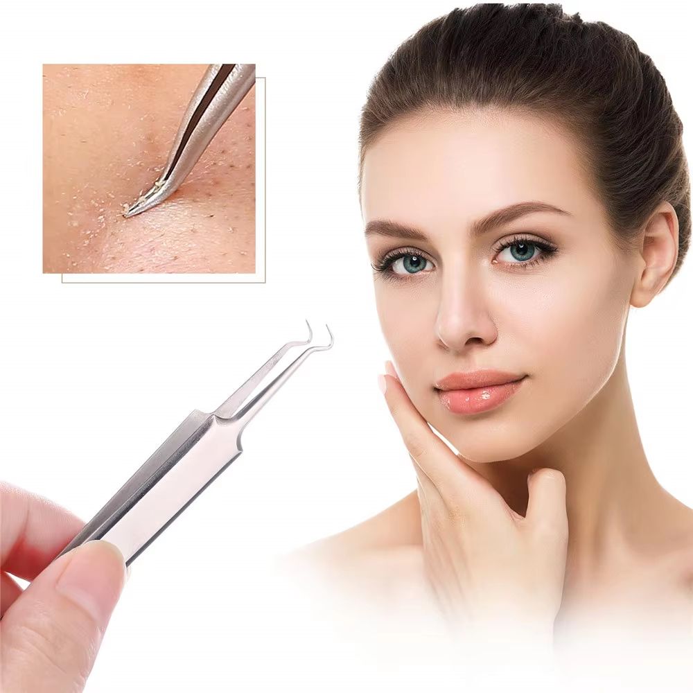 German UltraFine No 5 Blackhead  Pimple Tweezers  Precision Acne Needle Tool For Facial Care 5