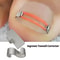 Professional Ingrown Toenail Corrector Tool Set Pedicure Treatment Foot Care Kit 0