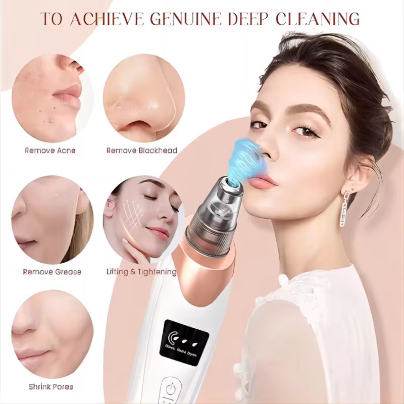 Electric Blackhead Remover Vacuum Pore Cleaner For Acne And Deep Facial Extraction 1