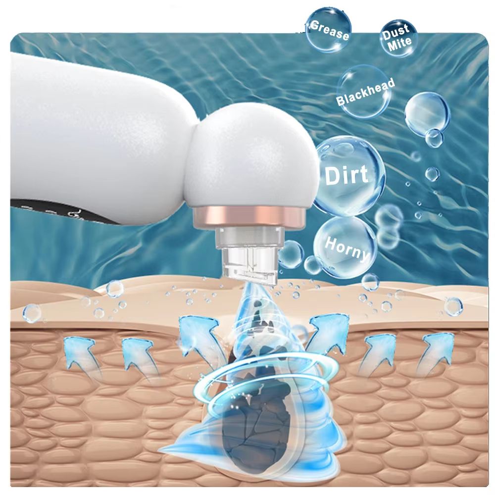 Electric Blackhead Remover Vacuum Suction Pore Cleaner For Face And Nose 1