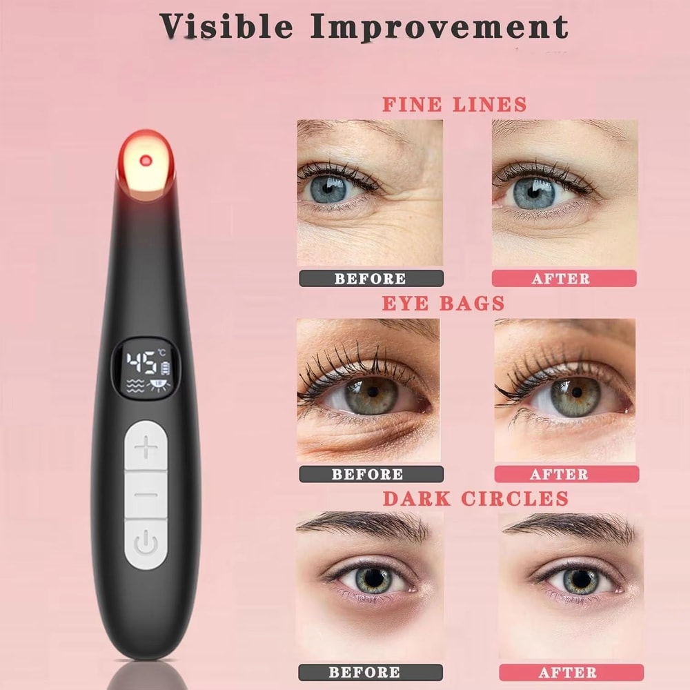 3in1 LED Eye Lift Wand With Red Light Therapy Vibration Heat For Puffiness Dark Circles Dry Eye R 1