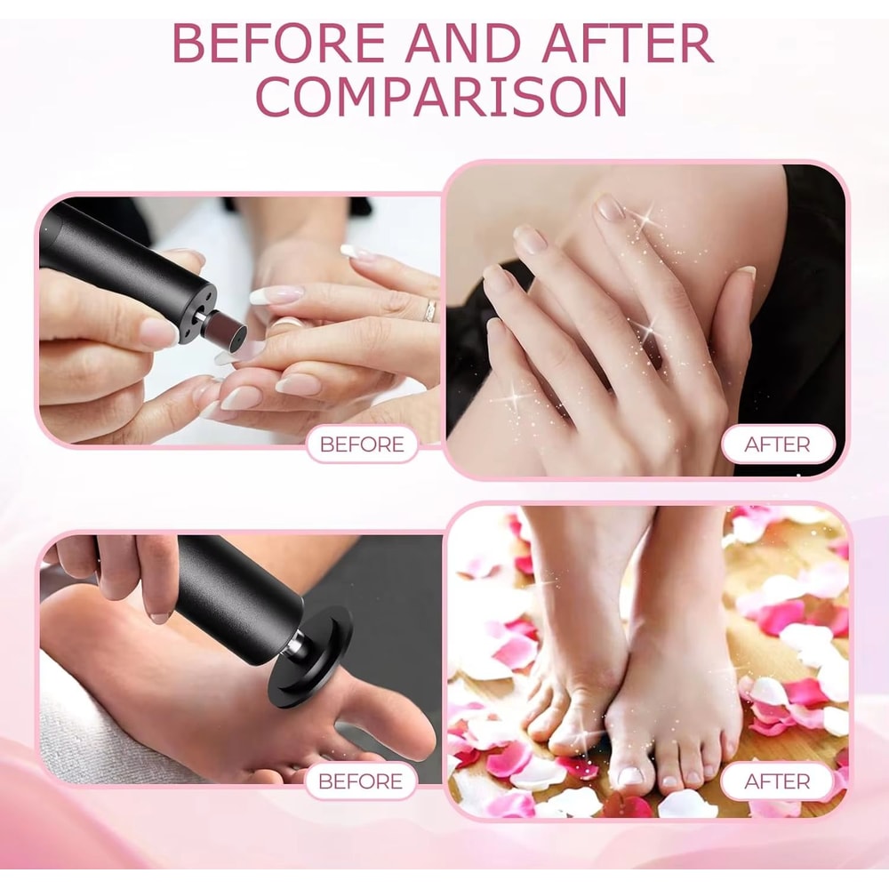 2in1 Electric Foot Callus Remover Nail Grinder With 6 Speeds And Sandpaper Foot Sander Tool 3