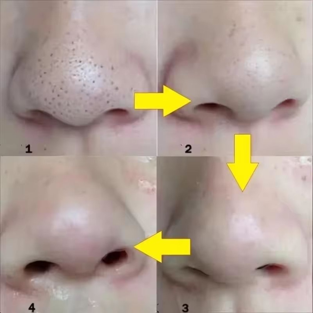 Deep Cleansing Nose Pore Blackhead Removal Patches 101520 PCS 3