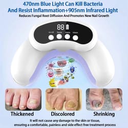 portable laser nail fungus treatment device for onychomycosis and ingrown toenails