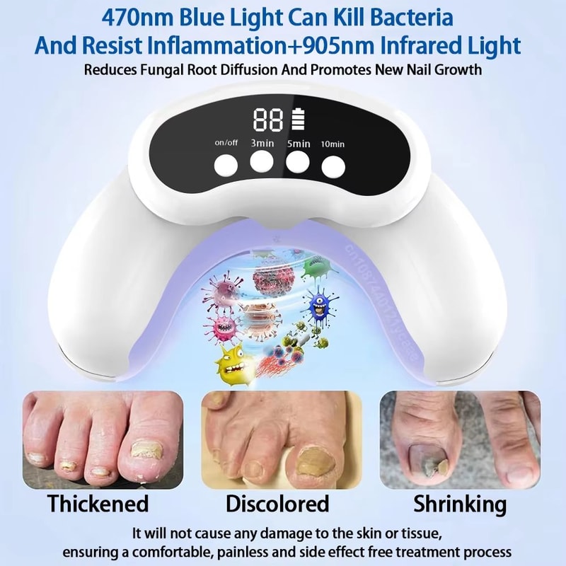 Portable Laser Nail Fungus Treatment Device For Onychomycosis And Ingrown Toenails 0