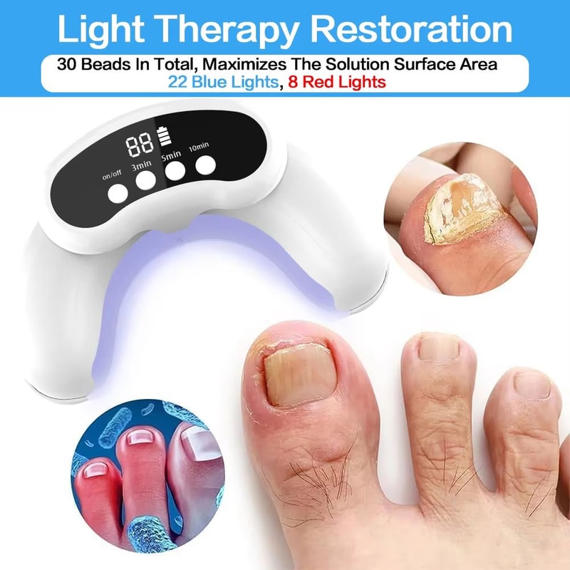 Portable Laser Nail Fungus Treatment Device For Onychomycosis And Ingrown Toenails 1