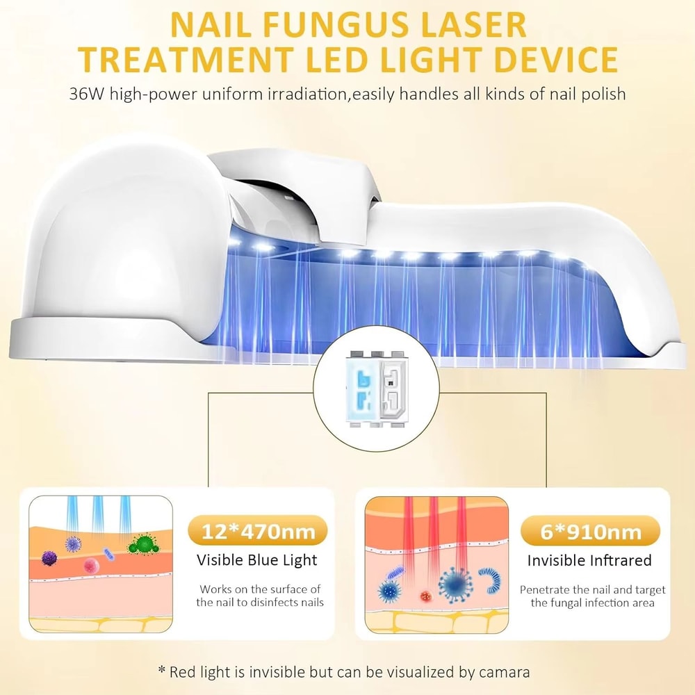 Portable Laser Nail Fungus Treatment Device For Onychomycosis And Ingrown Toenails 2