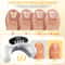 Portable Laser Nail Fungus Treatment Device For Onychomycosis And Ingrown Toenails 3