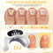Portable Laser Nail Fungus Treatment Device For Onychomycosis And Ingrown Toenails 3