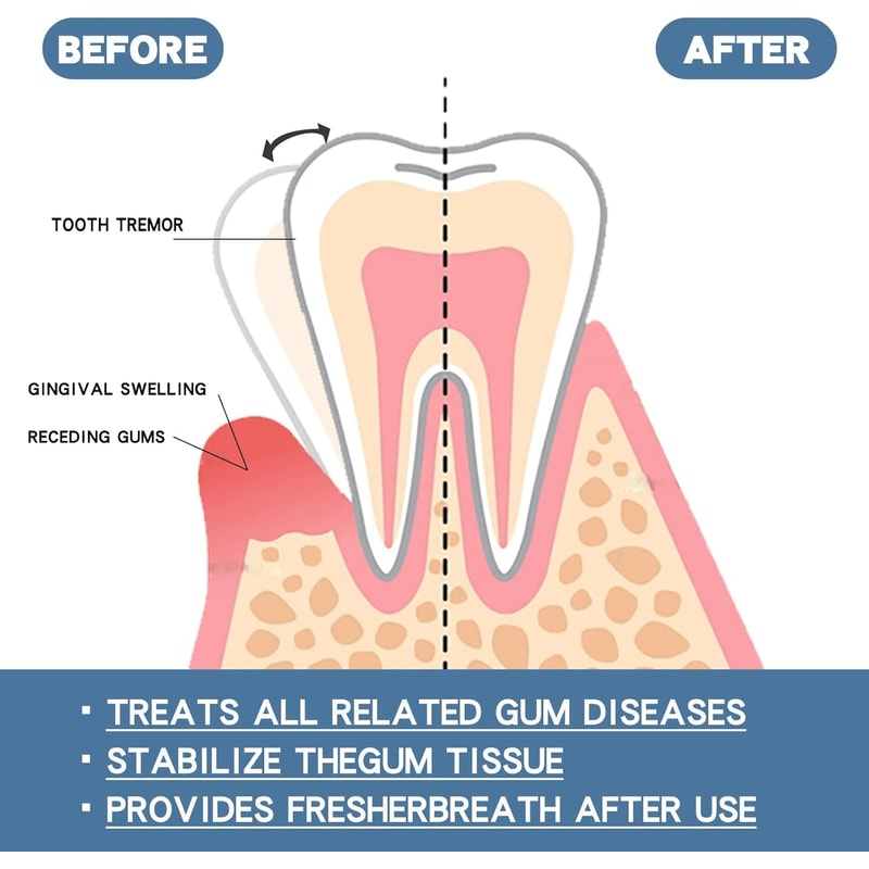 Rapid Repair Gums Serum Instant Relief For Sensitive Teeth Cavities Gum Damage 2