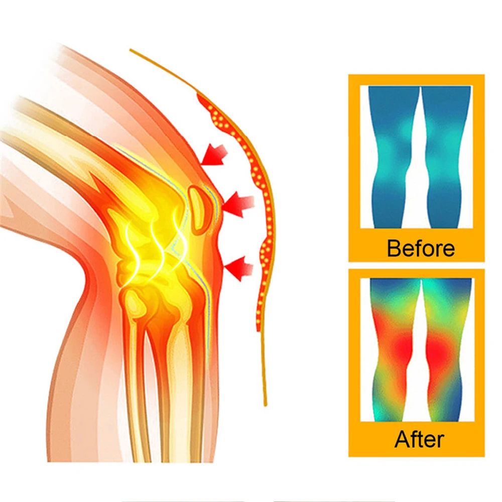 SelfHeating Knee Support Pads 2Pack For Pain Relief And Warmth 2