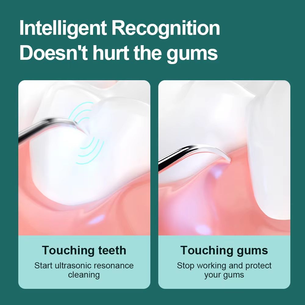 USB Rechargeable Electric Dental Scaler Ultrasonic Tartar Remover With LED Precision Teeth Cleaner 3