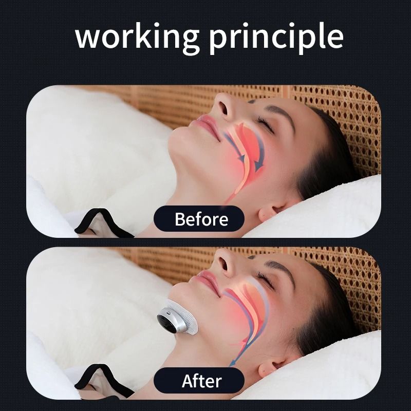 Smart Magnetic Anti Snoring Device EMS Nose Clip Sleep Aid 3