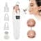 Blackhead Remover Vacuum Pore Cleaner For Deep Facial Cleansing Acne Care 1