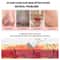 Ultrasonic Skin Scrubber Face Spatula For Deep Cleansing Blackhead Removal 5