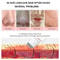 Ultrasonic Skin Scrubber Face Spatula For Deep Cleansing Blackhead Removal 5