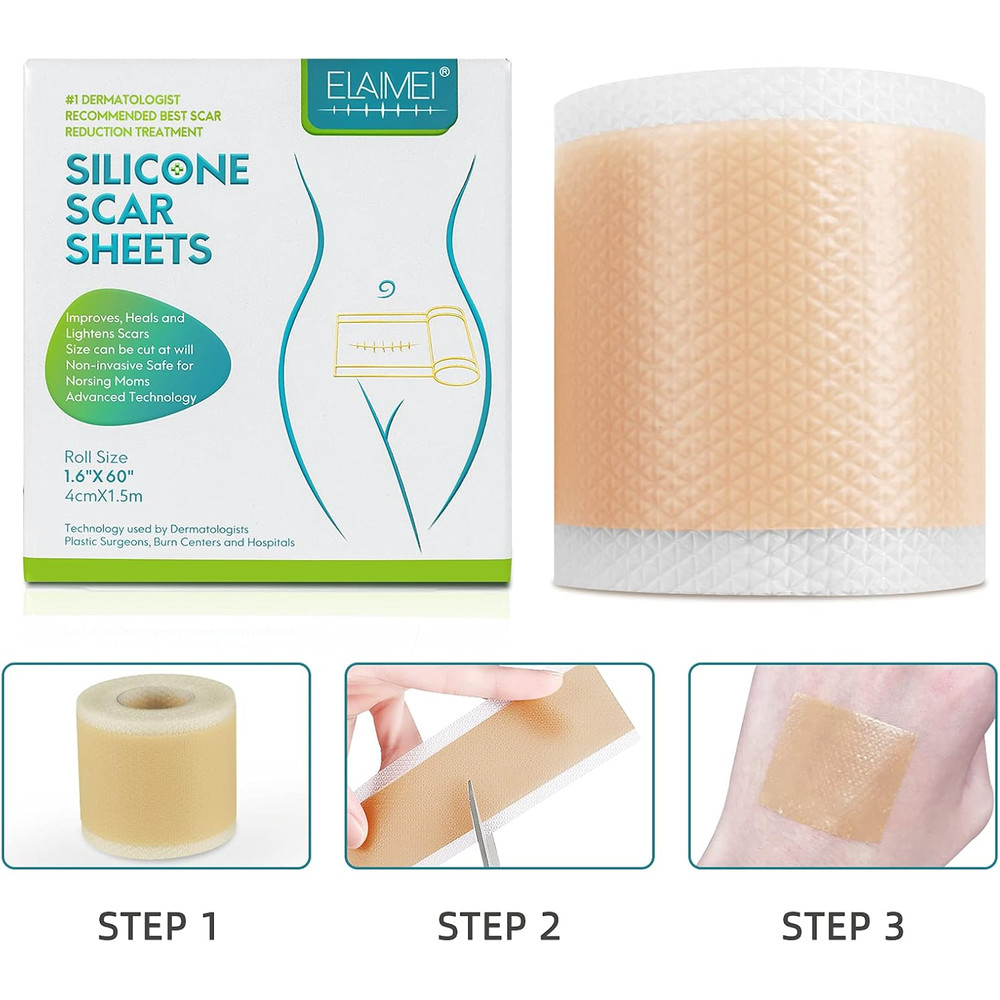 150cm SiliconTreatment E Scar Treatment Tape  Reusable Gel Patch For Acne Burn Surgical  Trauma Sca 1