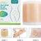 150cm SiliconTreatment E Scar Treatment Tape Reusable Gel Patch For Acne Burn Surgical Trauma Sca 1