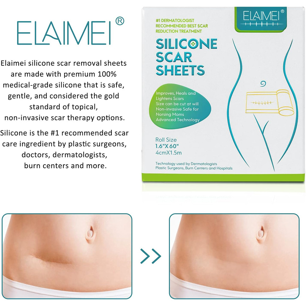 150cm SiliconTreatment E Scar Treatment Tape  Reusable Gel Patch For Acne Burn Surgical  Trauma Sca 2