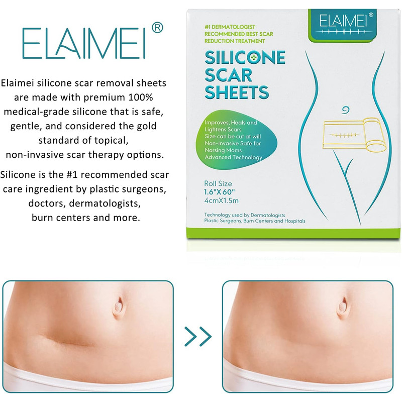 150cm SiliconTreatment E Scar Treatment Tape  Reusable Gel Patch For Acne Burn Surgical  Trauma Sca 2