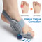 Bunion Splint Big Toe Straightener Orthopedic Foot Corrector For Hallux Valgus Pain Relief 0