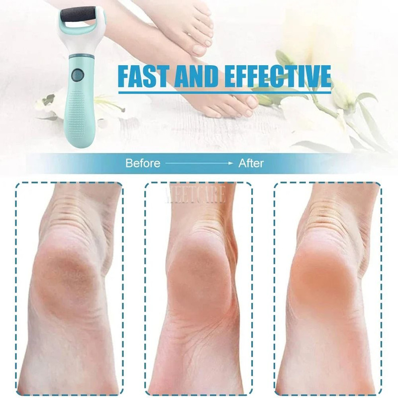 Electric Foot Grinder Callus Remover Pedicure Tool 2