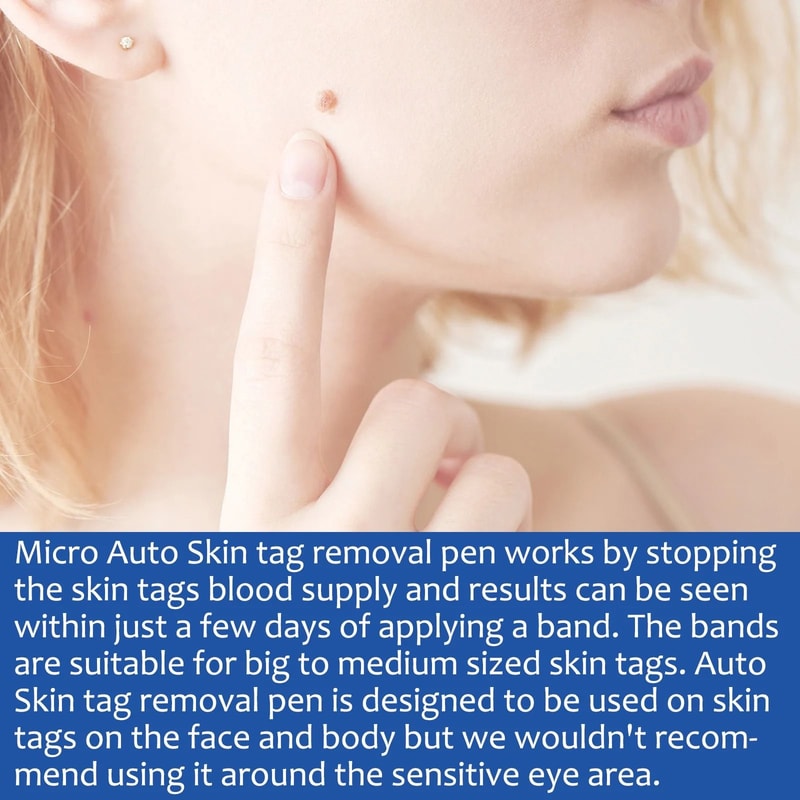 2 In 1 Painless Auto Skin Tag And Mole Remover Kit 3
