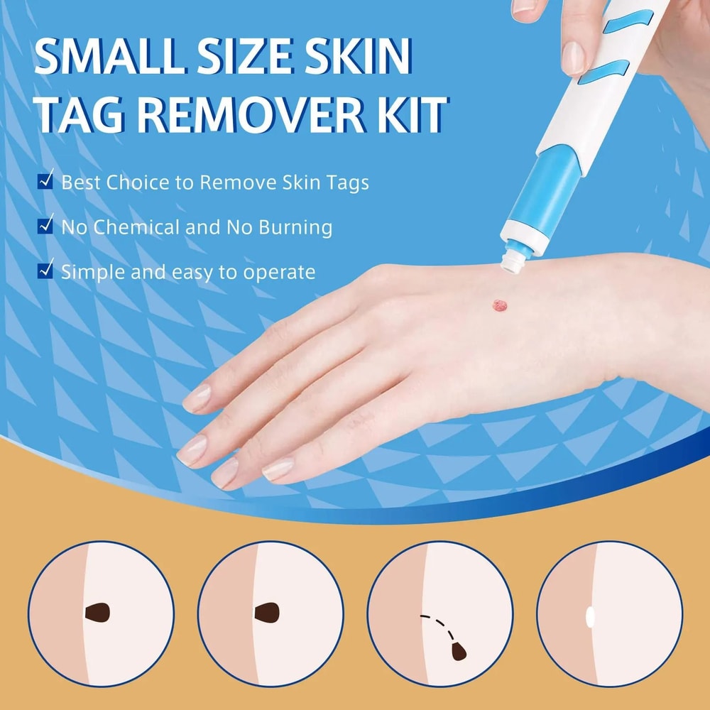 Auto Small Size Skin Tag Removal Kit For Home Facial Skin Care 1 To 4mm Tags 2
