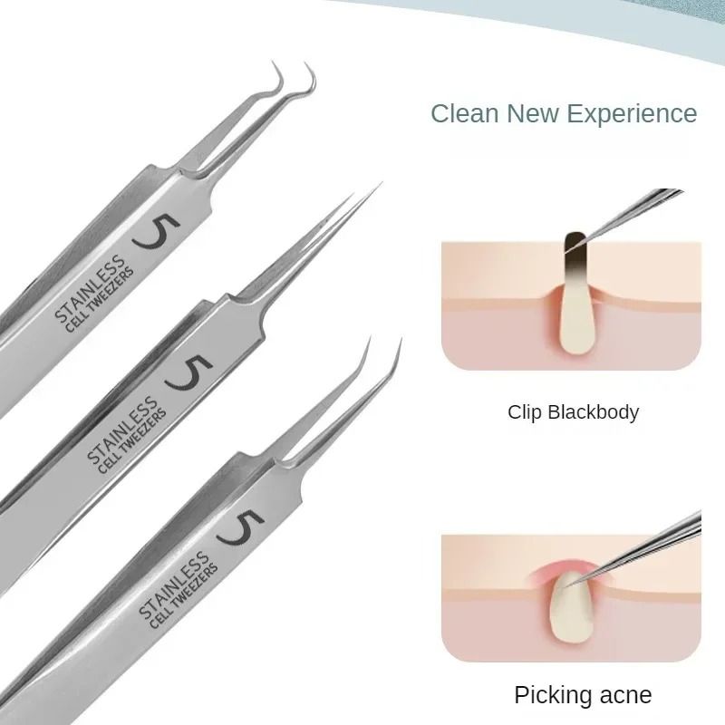 FaciaAcne And Blackhead Remover Tool Set With Ultra Fine Tweezers And Extractor Needles 1