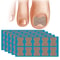 Nail Correction Stickers For Ingrown Toenail Support And Pedicure Care 0