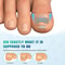 Nail Correction Stickers For Ingrown Toenail Support And Pedicure Care 3