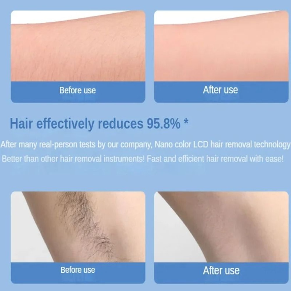 Crystal Hair Removal Tool For Painless Body Exfoliation And Depilation 2