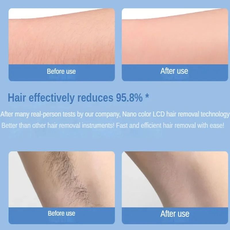 Crystal Hair Removal Tool For Painless Body Exfoliation And Depilation 2