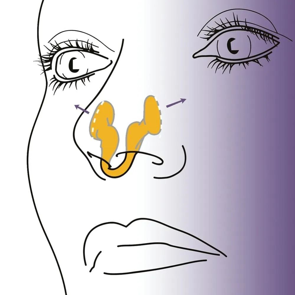 Silicone Nose Clip Anti Snoring Nasal Dilator For Better Breathing And Sleep Improvement 4