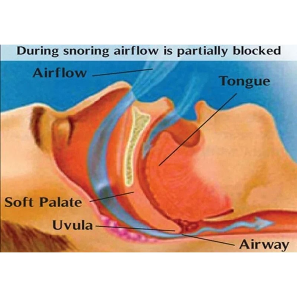 Anti Snoring Nose Clip Set For Better Breathing And Restful Sleep 3