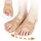 Fabric Corrector Breathable Adjustable Spacer Separator Toe Corrector 5
