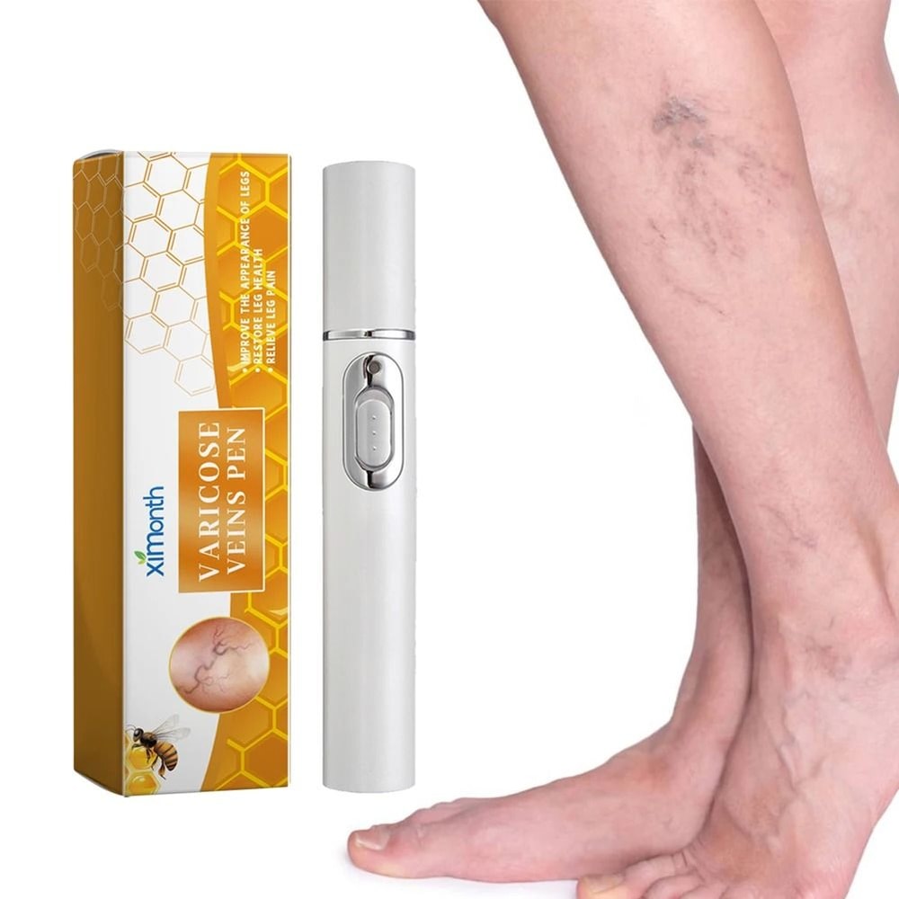Varicose Vein Relief Pen For Soothing Leg Discomfort And Promoting Circulation 1