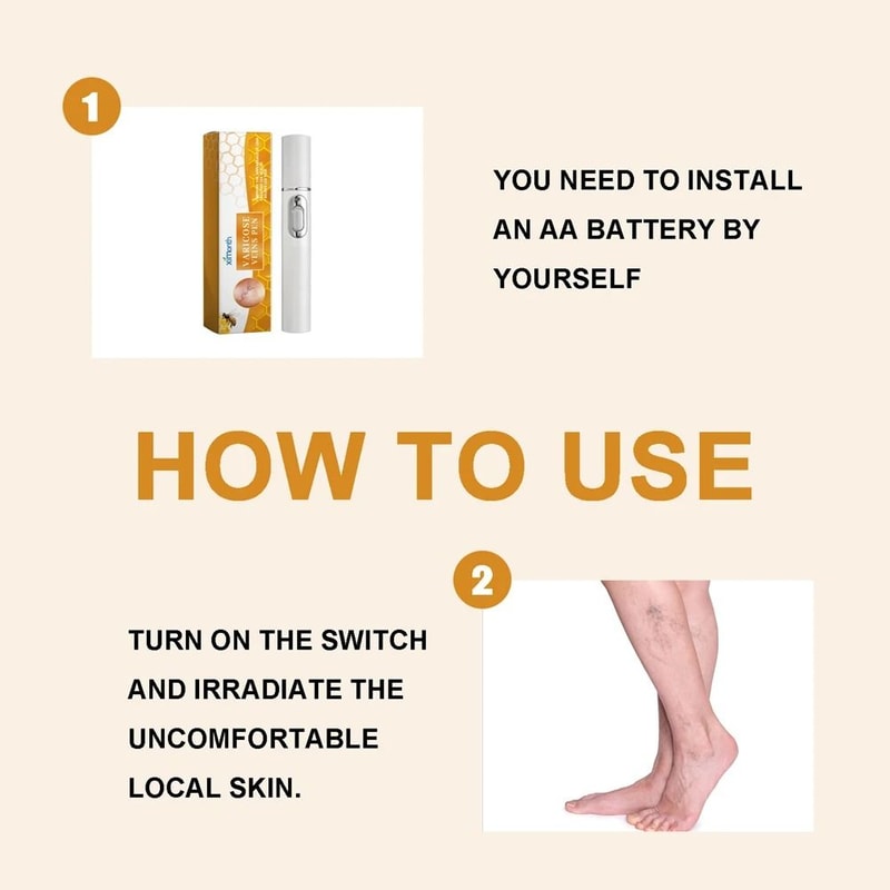 Varicose Vein Relief Pen For Soothing Leg Discomfort And Promoting Circulation 3