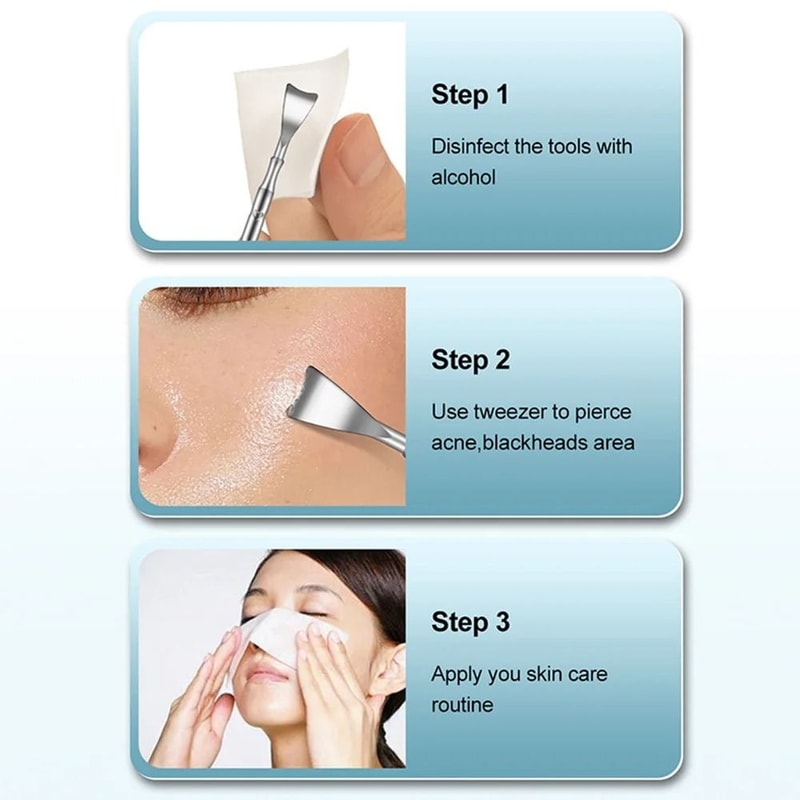 Double Ended Stainless Steel Blackhead And Acne Removal Needle For Facial Cleaning 3