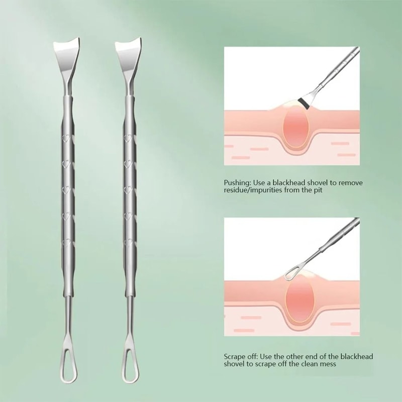 Double Ended Stainless Steel Blackhead And Acne Removal Needle For Facial Cleaning 4