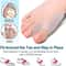 Soft Big Toe Corrector Set For Bunion Relief And Night Support 5